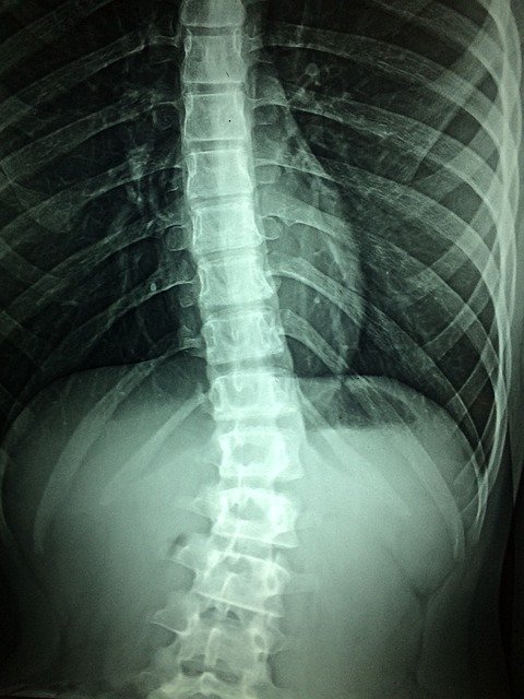 Spinal Cord X-ray
