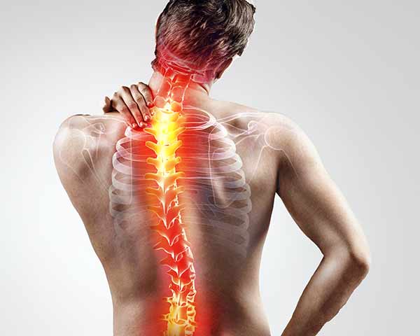failed-back-surgery-syndrome-shoreside-pain Failed back surgery treatment at Shoreside interventional Pain in Rogers, AR Florida.