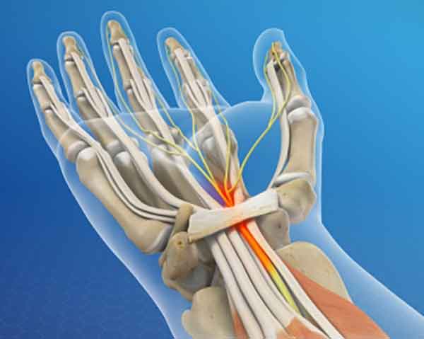 peripheral-nerve-block-pain-management-shoreside-pain peripheral nerve block for pain management.