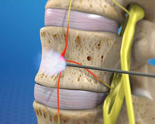 sympathetic-nerve-block-pain-management Pain management Rogers, Arkansas.